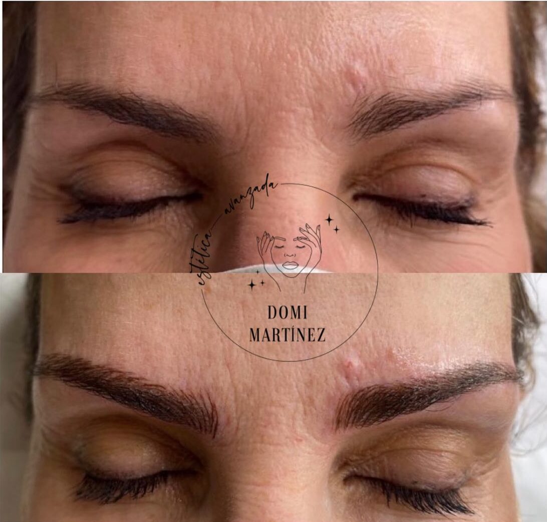 Microblading de cejas: